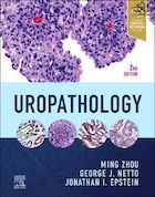 Uropathology E-Book 2nd Edición | آسیب شناسی ادراری